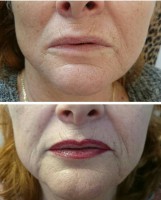 /album/fotogalerie/rty-bety-9-2-17-jpg3-jpg/